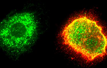 Fiches maladies - Fièvre de Lassa - Institut Pasteur