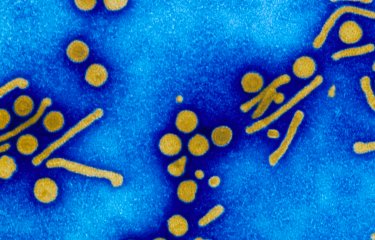 Fiches maladies - Hépatites virales - Institut Pasteur