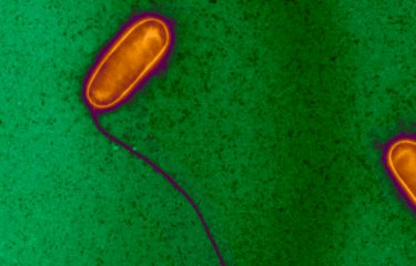 Fiches maladies - Légionellose - Institut Pasteur