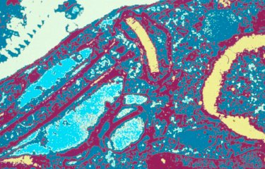 Fiches maladies - Leishmanioses - Institut Pasteur