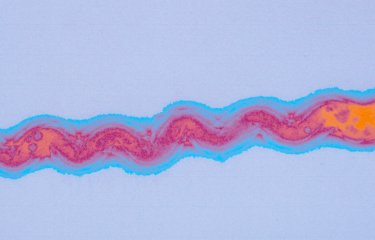 Fiches maladies - Leptospirose - Institut Pasteur