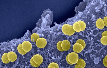 Fiches maladies - Méninges à méningocoques - Institut Pasteur