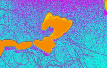 Fiches maladies - Salmonellose - Institut Pasteur