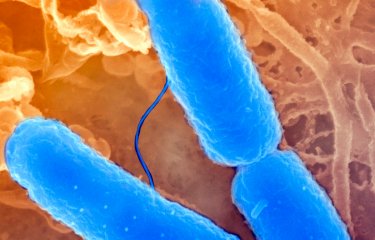 Fiches maladies - Shigellose - Institut Pasteur