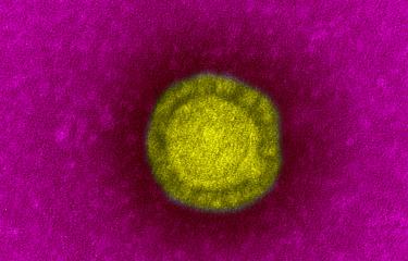 Coronavirus de Wuhan (décembre 2019)