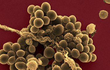 Fiches maladies - Staphylocoques - Institut Pasteur