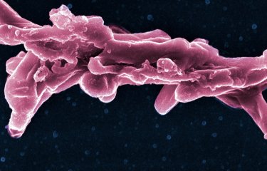 Fiches maladies - Tuberculose - Institut Pasteur