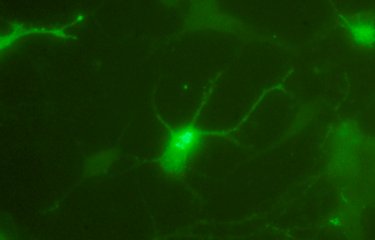 Fiches maladies - West Nile - Institut Pasteur