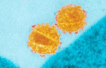 VIH : Identification de récepteurs clés de la réponse immunitaire chez les patients contrôlant spontanément l'infection - Institut Pasteur