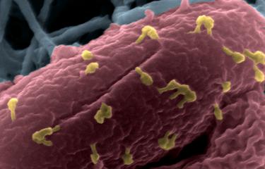 Bactériophages sur la bactérie Escherichia coli 