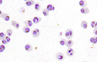 Paludisme - Découverte chez le parasite d'un marqueur moléculaire associé à la résistance au traitement à la piperaquine - Institut Pasteur