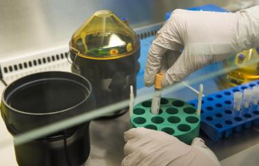 Ebola : 3 variants du virus identifiés en Guinée - Institut Pasteur