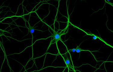 Comment la nicotine agit sur le cerveau des schizophrènes 