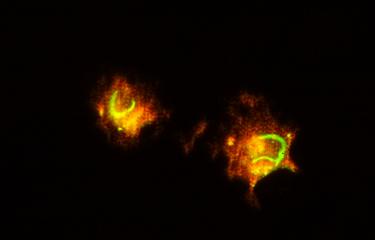 Infection de macrophage par le virus de la fièvre de la vallée du Rift.