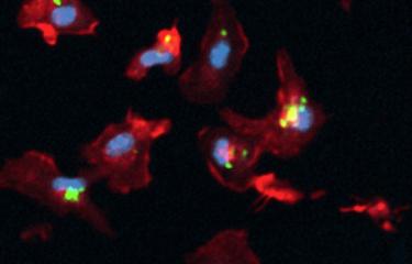 Macrophages infectés par M. tuberculosis (en vert), observés par microscopie confocale. © Réseau international des Instituts Pasteur