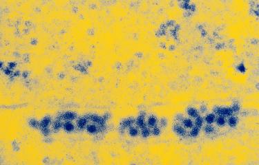 Virus de la fièvre jaune (souche vaccinale 17D) dans des cellules humaines © Institut Pasteur