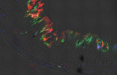 Dysenterie : Shigella, une bactérie qui s’adapte à toutes les respirations