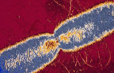 Nouvel éclairage sur la dissémination de la résistance aux carbapénèmes chez Escherichia coli