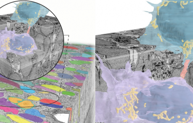 Identification de tunnels connectant les neurones dans le cerveau en développement