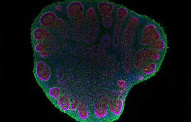 Observation d'un organoïde cérébral de 2 mois au microscope