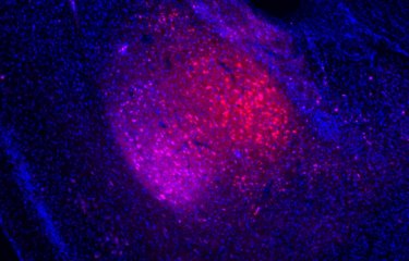 Dépression : un dysfonctionnement de certains neurones de l’amygdale serait à l’origine de la perception négative de l’environnement 