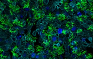 Nouvelle découverte sur les récepteurs d’entrée des coronavirus dans les cellules humaines 