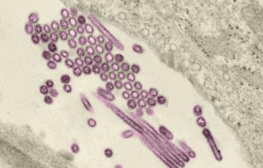 Les calpaïnes, enzymes cellulaires clés pour la lutte anti-grippale