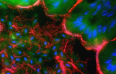 La flore intestinale en renfort de l’immunothérapie en cancérologie