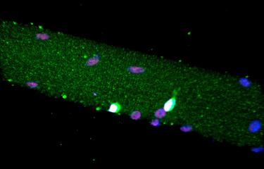 Médecine régénérative : les cellules sénescentes en renfort de la reprogrammation cellulaire