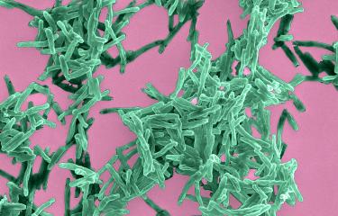 Tuberculose : découverte d’une étape critique de l’évolution du bacille vers la pathogénicité