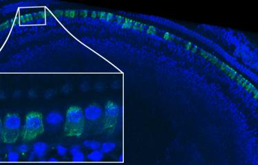 épithélium sensoriel d’une cochlée 