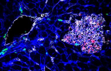 Listeria monocytogenes