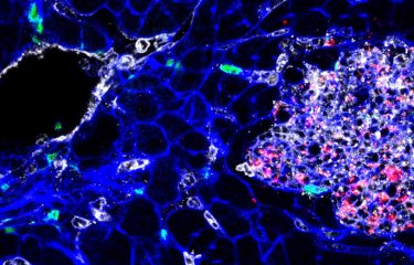 Listeria : des souches hypervirulentes à tropisme cérébral et placentaire - Institut Pasteur