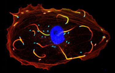 Cellule infectée par Listeria monocytogenes.en microscopie à fluorescence 