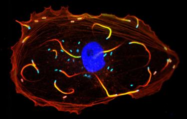 https://www.pasteur.fr/sites/default/files/styles/teaser_-_fiche_maladie/public/rubrique_journal_de_la_recherche/actualites/actualites_janvier_2017/institutpasteur_25514.jpg?itok=CUfD6Yj_