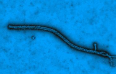 Ebola virus - Institut Pasteur