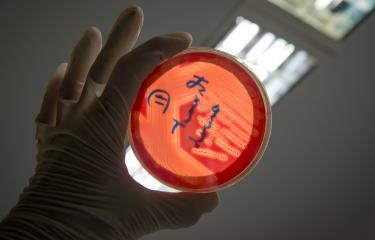 Streptococcus - Institut Pasteur