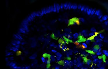 cellules lymphoïdes innées de type 3 - Institut Pasteur