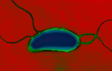 Vibrio cholerae - Institut Pasteur