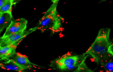 Streptocoques A et B : informations et traitement - Institut Pasteur