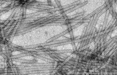 Journal de la Recherche - Un virus issu d’un environnement extrême