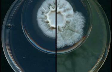 Aspergillus - Pseudomonas - Institut Pasteur