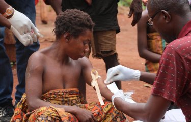 MonkeyPox - Institut Pasteur - Institut Pasteur de Bangui