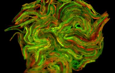 Mycobacterium - fluoresecence - Institut Pasteur