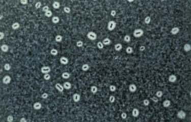 Klebsiella - Institut Pasteur