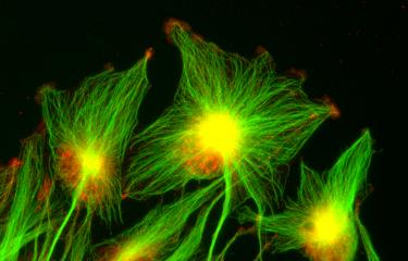 gliomes polarisation - Institut Pasteur