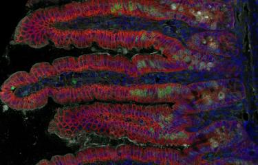 listeria - institut pasteur