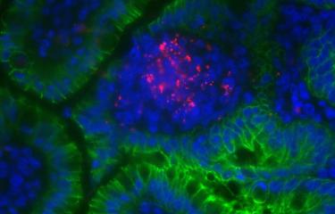 Listeria monocytogenes (rouge/red) - Institut Pasteur