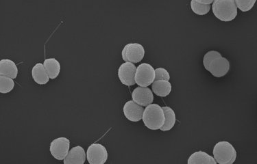 Neisseria meningitis - Institut Pasteur