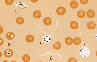 Institut Pasteur - Journal de la Recherche - Paludism